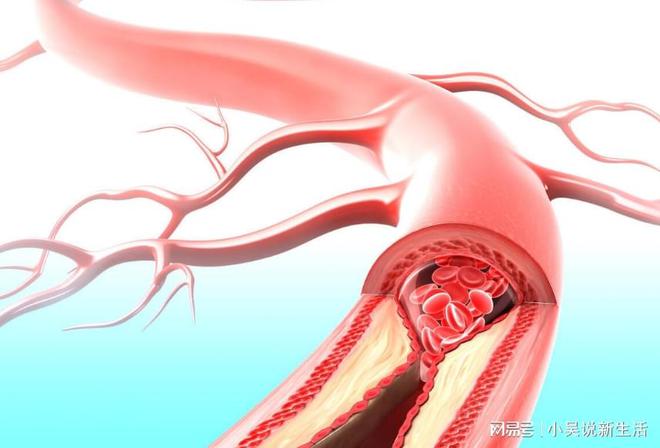 提醒：4种水果是寄生虫的“重灾区”宁愿少吃或不吃也别贪(图6)